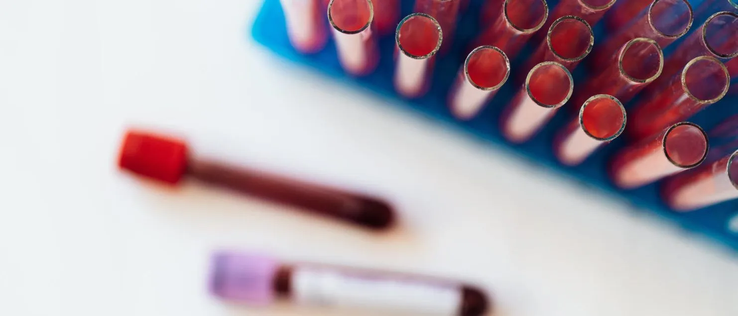 Understanding Blood Test Ranges | Strength of Saad